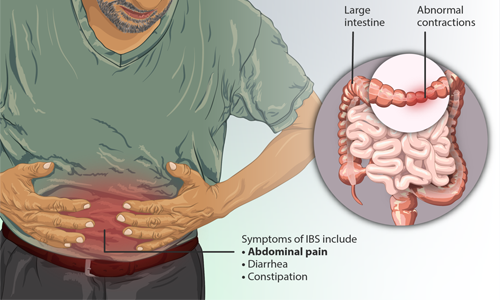经常腹泻怎么处理？如何有效解决？(图1)